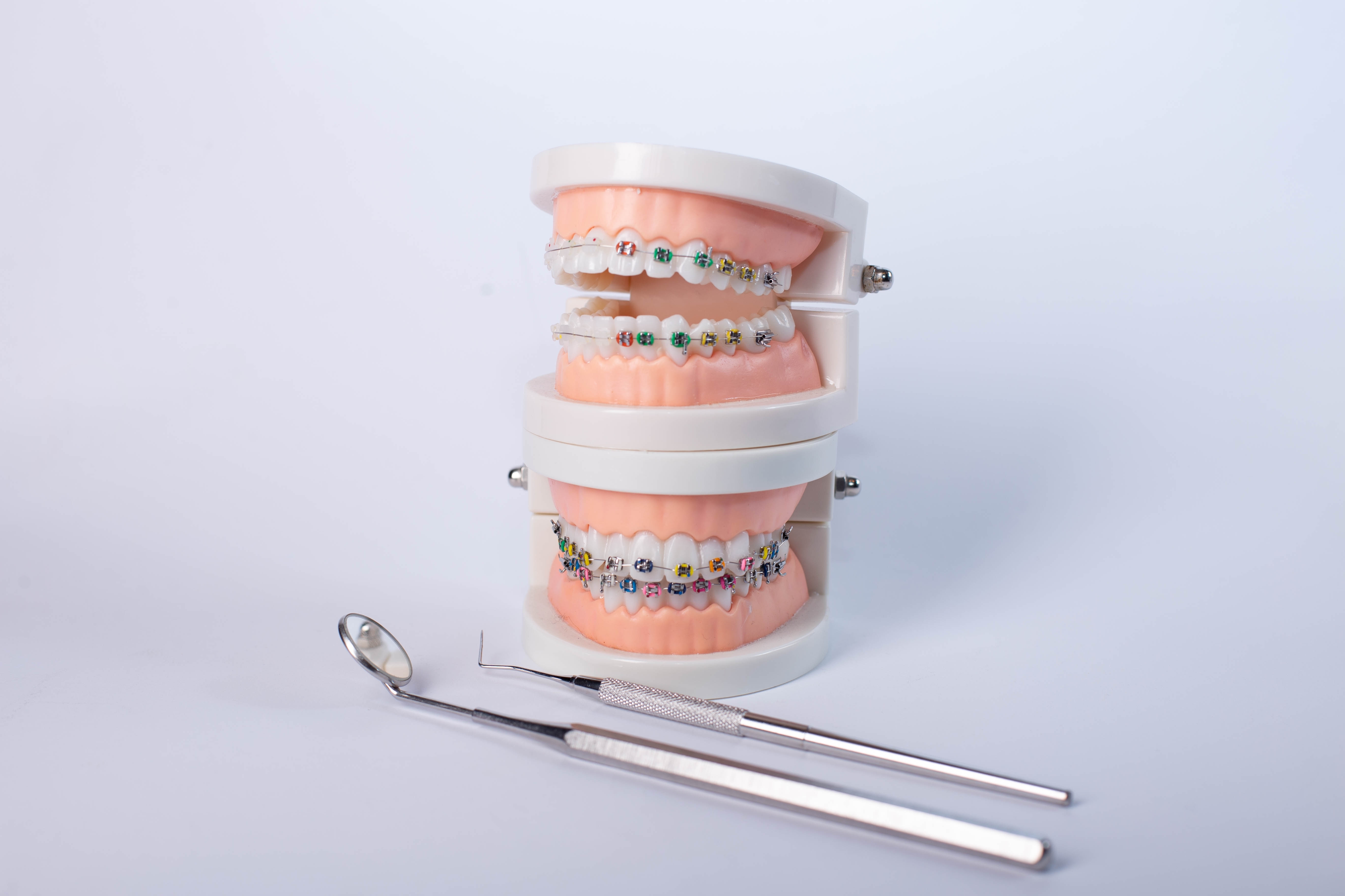 The Best Dental Insurance Options in DFW That Cover Orthodontics Without Long Waiting Periods